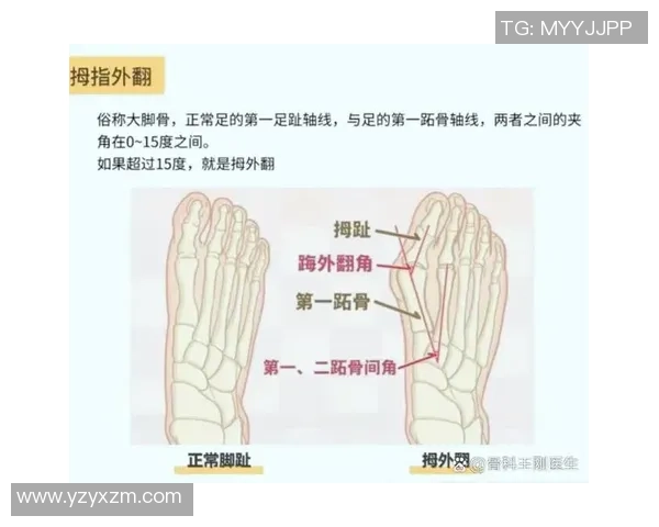 足球运动中常见的脚趾疼痛原因及缓解方法详解